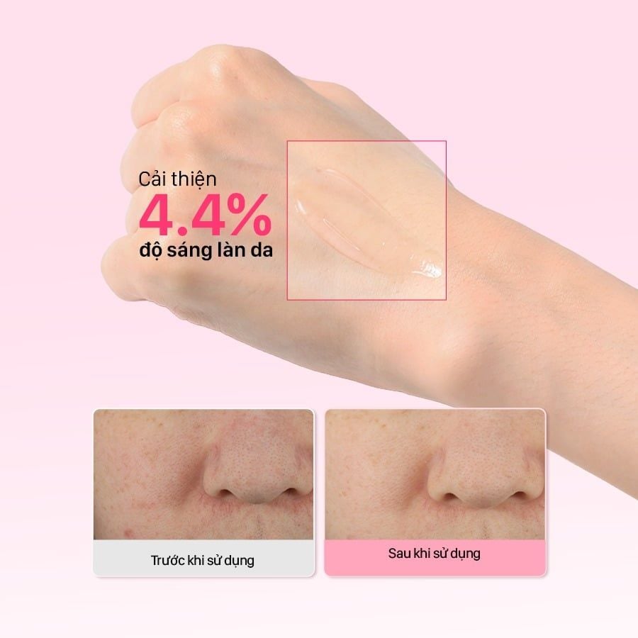  Tinh Chất Dưỡng Sáng, Phục Hồi CNP Derma Answer Pink Toning Deep In Shot Ampule 15ml/ 30ml 
