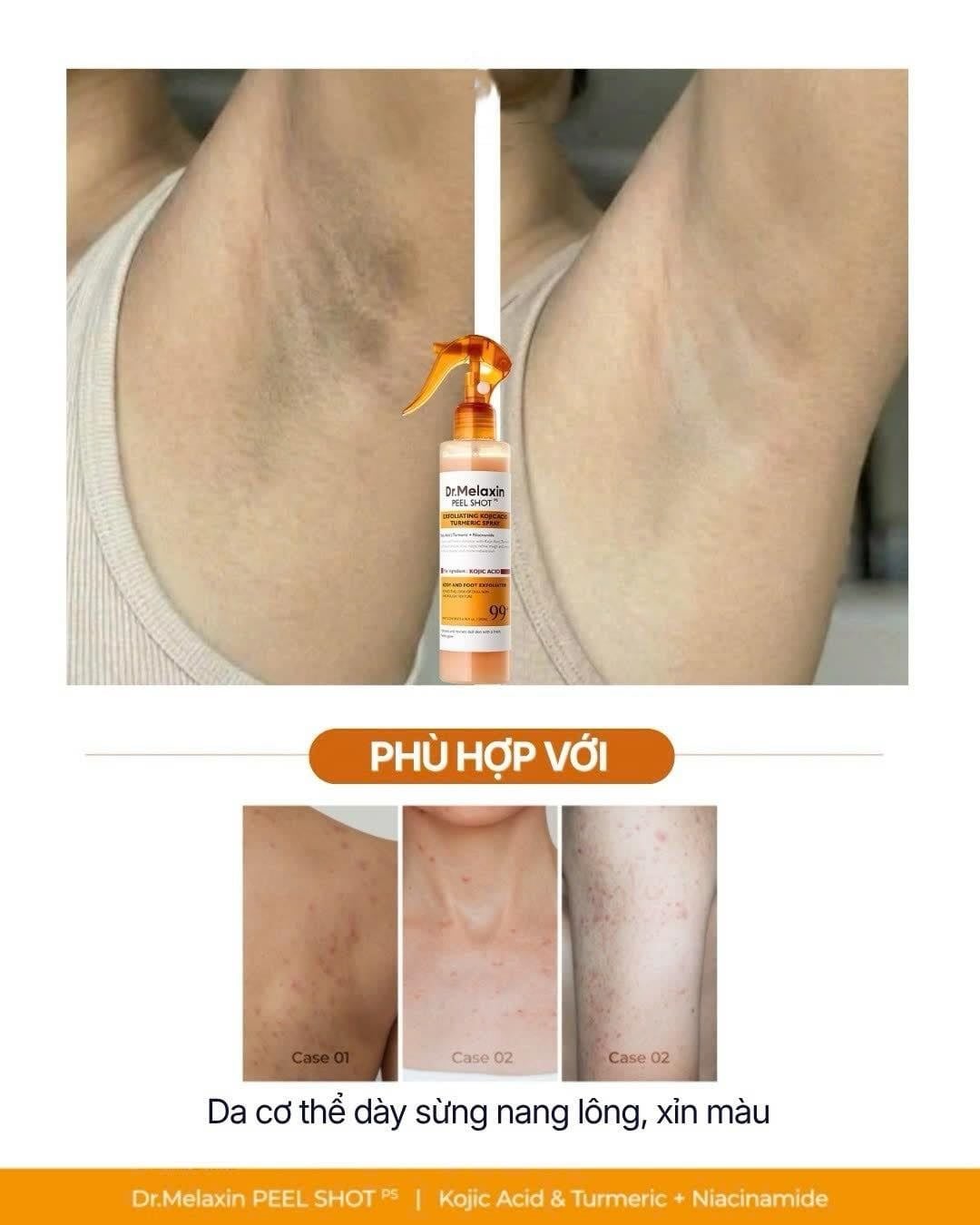  Dung Dịch Xịt Tẩy Tế Bào Chết Cơ Thể Dr.Melaxin Peel Shot Exfoliating Kojic Acid Turmeric Spray 200ml 