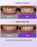  (MINI SIZE) Kem đánh răng Euthymol Original Toothpaste Whitening Purple Corrector 20g 