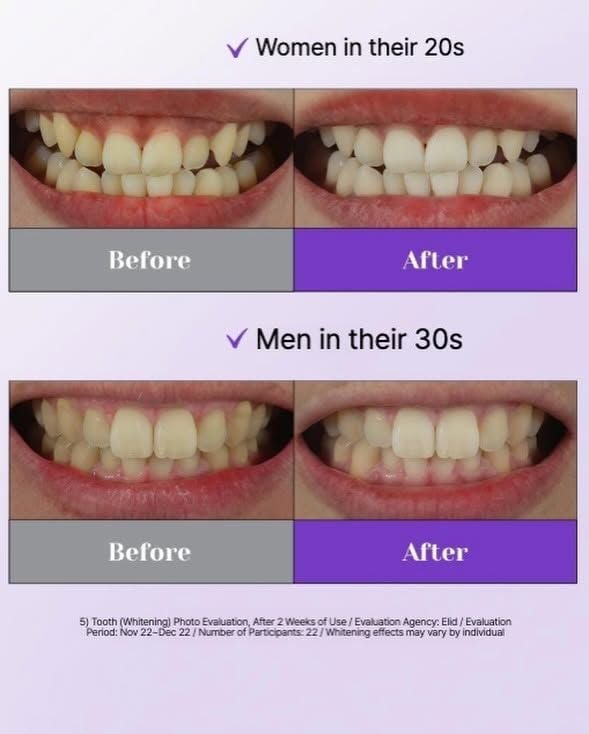  (MINI SIZE) Kem đánh răng Euthymol Original Toothpaste Whitening Purple Corrector 20g 
