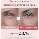  Kem Dưỡng Mắt Chuyên Sâu Medicube PDRN Pink Peptide Eye Cream 30ml 