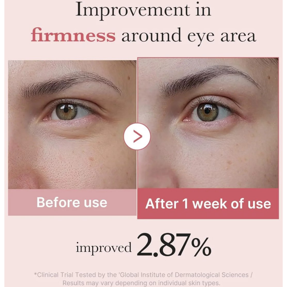  Kem Dưỡng Mắt Chuyên Sâu Medicube PDRN Pink Peptide Eye Cream 30ml 