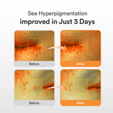  Toner Pad Dưỡng Ẩm, Sáng Da Abib Glutathiosome Dark Spot Pad 220ml (60 Miếng) 
