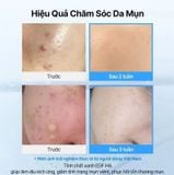  Tinh chất cấp ẩm, phục hồi da Klairs EGF Blue AC Calming Serum 50g 