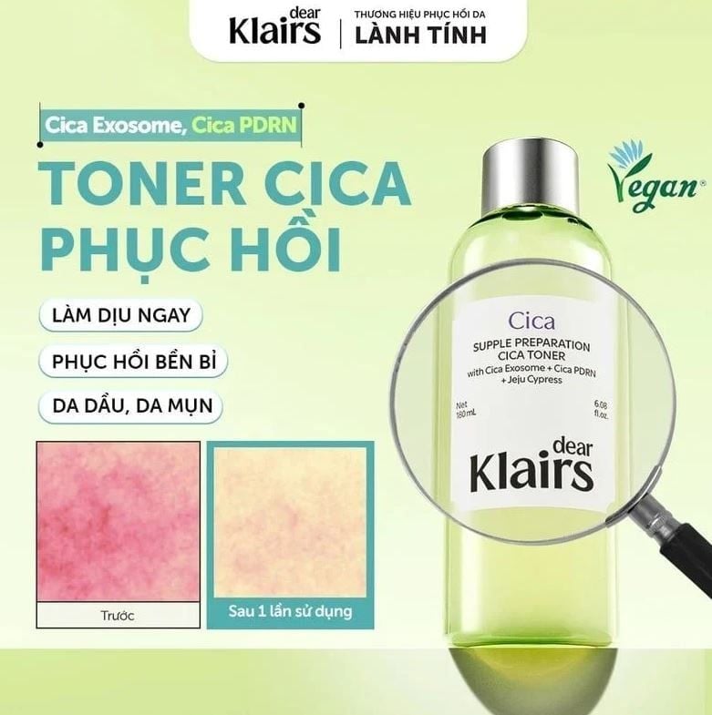  Nước Hoa Hồng Làm Dịu, Phục Hồi Klairs Supple Preparation Cica Toner 180ml 