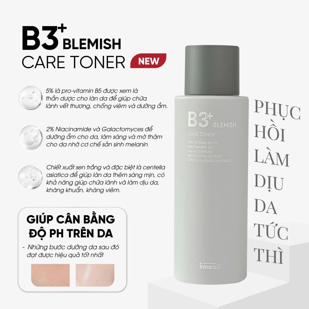  Nước Hoa Hồng Dưỡng Ẩm Innoskin B3 Blemish Care Toner 120ml 