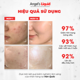  Nước Thần Dưỡng Trắng, Kiềm Dầu Angel's Liquid Glutathione+ Niacinamide Cica Essence 150ml (Bản ĐỎ) 
