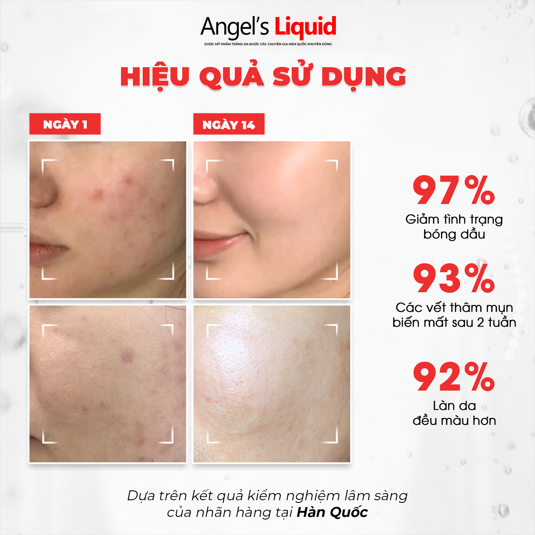  Nước Thần Dưỡng Trắng, Kiềm Dầu Angel's Liquid Glutathione+ Niacinamide Cica Essence 150ml (Bản ĐỎ) 