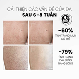  Sữa Tắm Giảm Mụn, Tẩy Tế Bào Chết MD CARE AHA & BHA Exfoliating Body Wash 200ml 