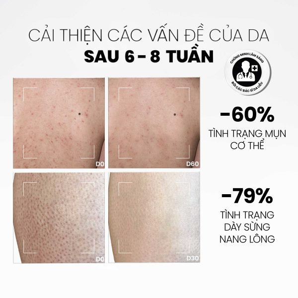  Sữa Tắm Giảm Mụn, Tẩy Tế Bào Chết MD CARE AHA & BHA Exfoliating Body Wash 200ml 