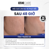  Kem Dưỡng Ẩm Phục Hồi Và Cải Thiện Nếp Nhăn MD CARE EPI-PROCARE CREAM 30ml 