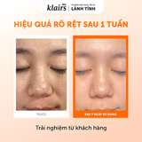  Nước Hoa Hồng Klairs Freshly Juiced Vitamin Essence Toner 180ml 