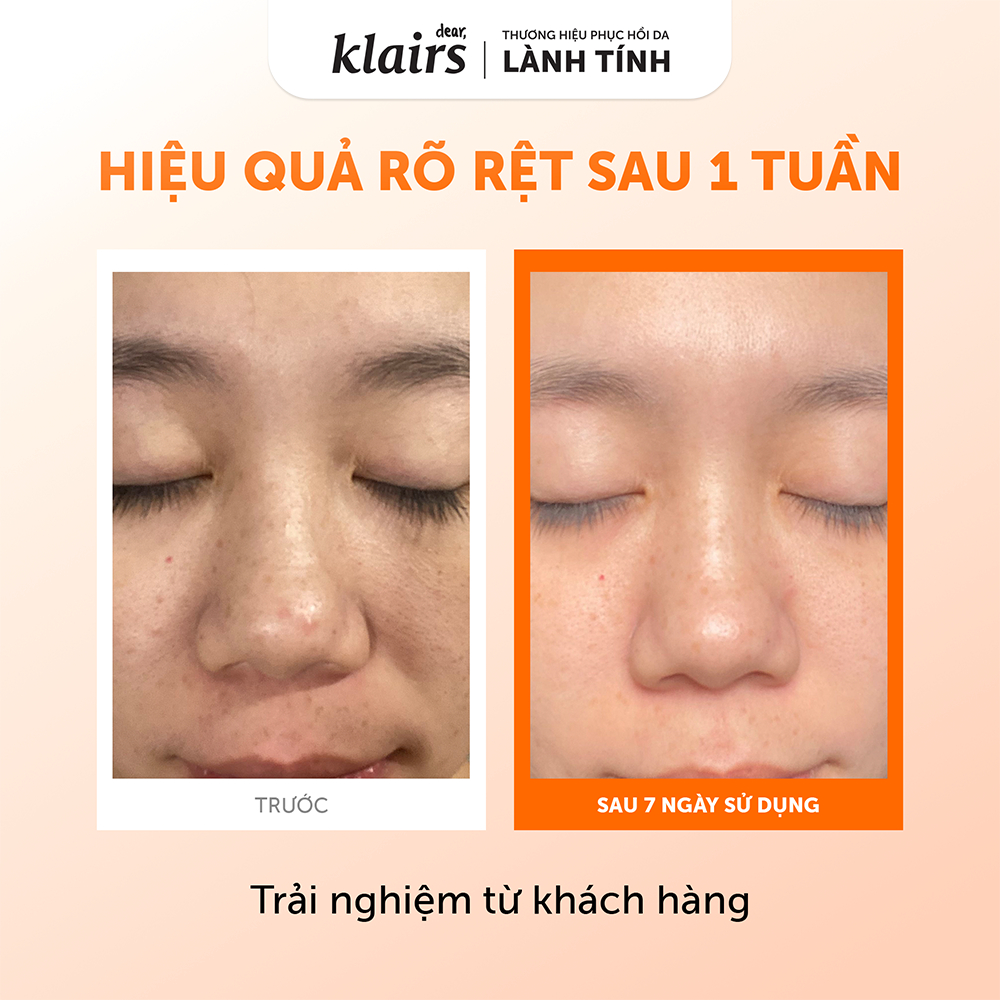  Nước Hoa Hồng Klairs Freshly Juiced Vitamin Essence Toner 180ml 