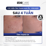  Kem Dưỡng Làm Sáng Và Cải Thiện Nếp Nhăn MD CARE PRO-RETINOL 0.6 30ml 
