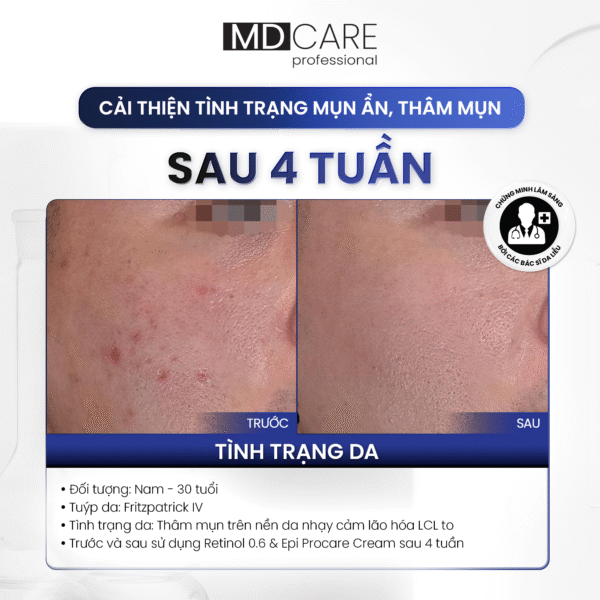  Kem Dưỡng Làm Sáng Và Cải Thiện Nếp Nhăn MD CARE PRO-RETINOL 0.6 30ml 