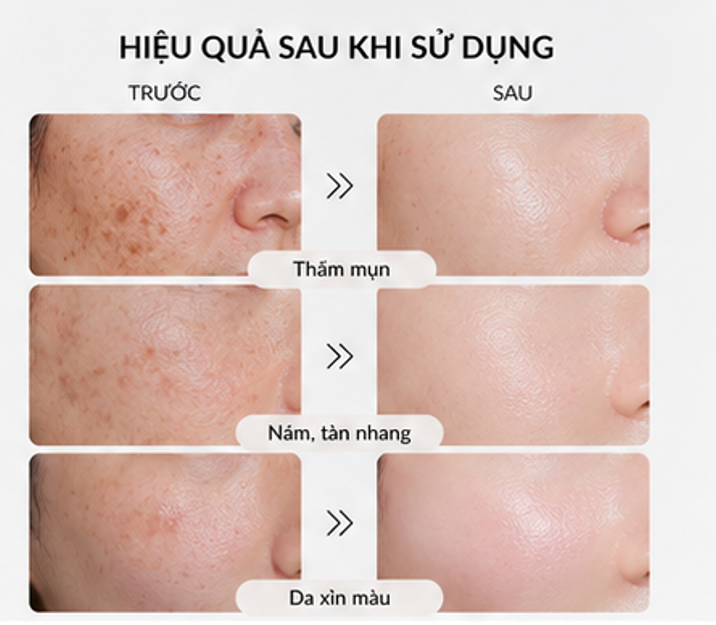  Tinh Chất Dưỡng Sáng, Mờ Thâm Nám Oh! Oh! Dark Spot Fading Serum 30ml 