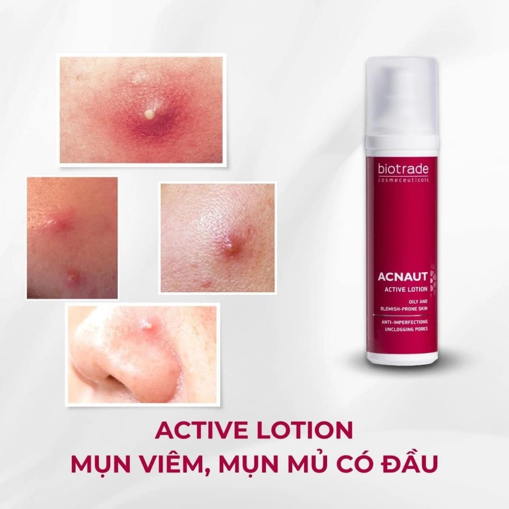  Sữa Dưỡng Chấm Mụn Biotrade Acnaut Active Lotion 15ml 