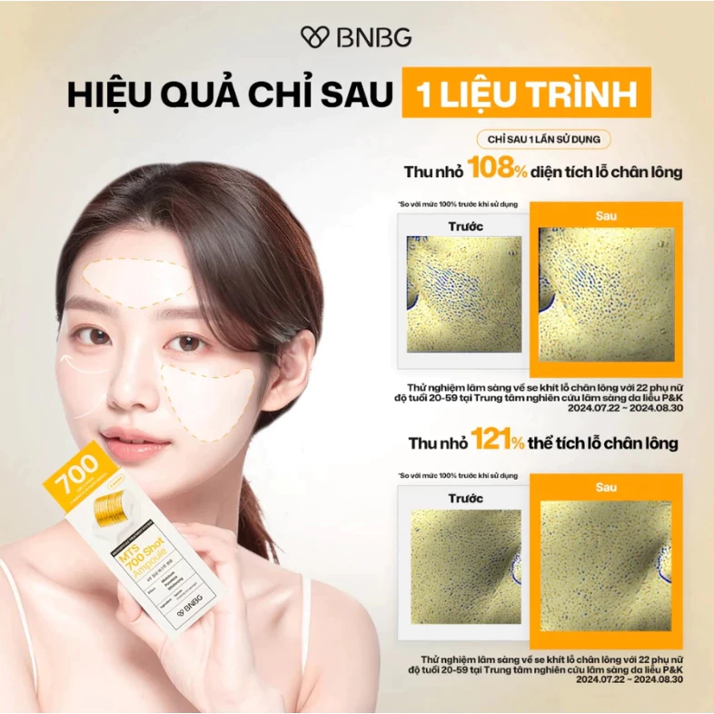  Tinh Chất Vi Kim Chuyên Sâu BNBG MTS Shot Ampoule 2ml (4 gói) 