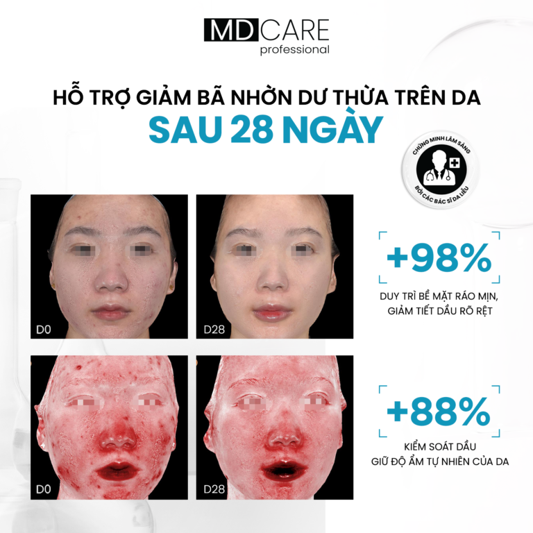  Tinh Chất Kiểm Soát Dầu Sinh Học MD CARE Zinc-PHA Sebum Regulation Complex Serum 30ml 