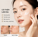  Kem Dưỡng Sinh Học Biomeek Sáng Da Mờ Thâm Biomeek Tranexide Cream 50ml 