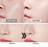  (Mẫu mới) Phấn Nước Renoderm Day Long BB Cream 15g 