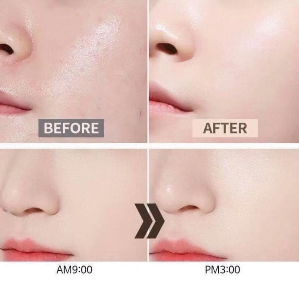  (Mẫu mới) Phấn Nước Renoderm Day Long BB Cream 15g 