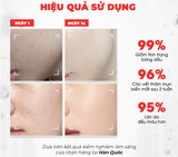  Tinh Chất Dưỡng Trắng, Kiềm Dầu Angel's Liquid Glutathione+ Niacinamide Cica Ampoule 45ml (Bản Đỏ) 