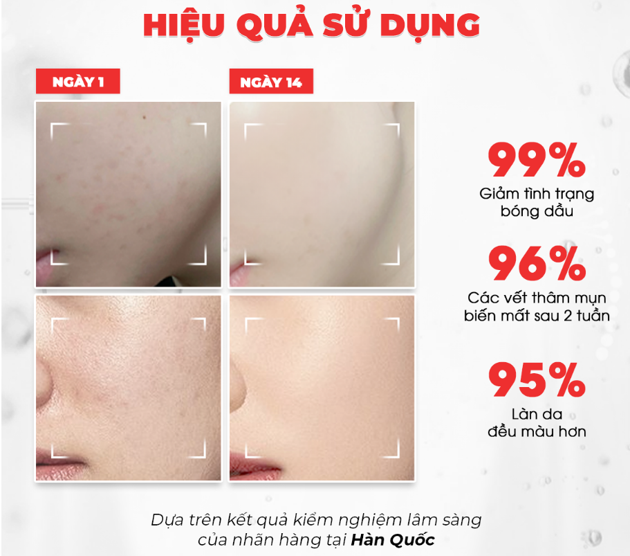  Tinh Chất Dưỡng Trắng, Kiềm Dầu Angel's Liquid Glutathione+ Niacinamide Cica Ampoule 45ml (Bản Đỏ) 