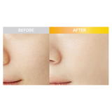  (VÀNG) Tinh Chất DR.G Sáng Da, Đều Màu Da DR.G 3D Vitamin C Niacinamide 5% Booster Serum 30ml 