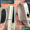 op-lung-chong-soc-honor-magic-8-pro-lung-cung-vien-deo-go-camera-cao-chong-bam-van-tay