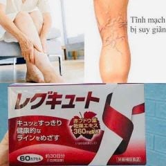 Viên Uống Suy Giãn Tĩnh Mạch Unitech Nhật Bản 60 Viên Giảm Đau Nhức Chân