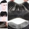 Miếng che hói dán chữ M