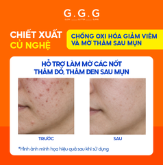 Serum Cam Dưỡng Sáng, Ngừa Mụn, Mờ Thâm - G.G.G Wonder Glow Healing Serum 40ml