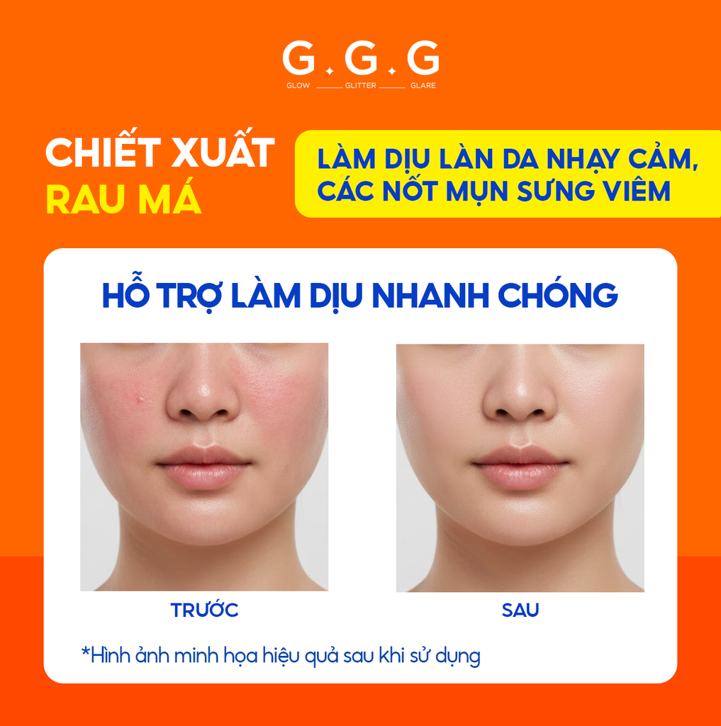 Serum Cam Dưỡng Sáng, Ngừa Mụn, Mờ Thâm - G.G.G Wonder Glow Healing Serum 40ml