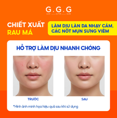 Serum Cam Dưỡng Sáng, Ngừa Mụn, Mờ Thâm - G.G.G Wonder Glow Healing Serum 40ml