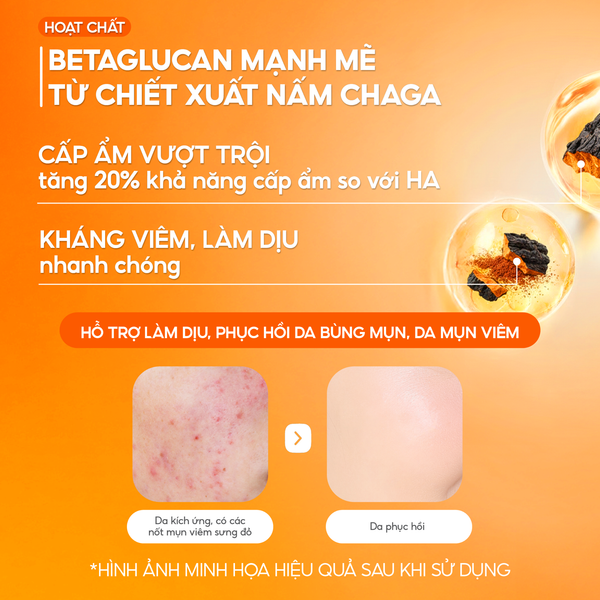 Booster Nấm Chaga, Tinh Chất Ampoule Cấp Ẩm Sâu Làm Dịu & Phục Hồi Da Tức Thì - GGG Uniq Booster Chaga 50ml