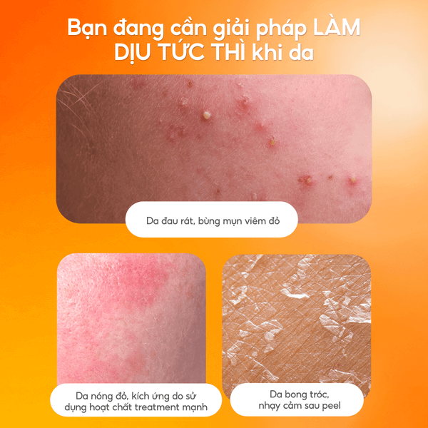 Toner Nấm Chaga Không Cồn Hỗ Trợ Cấp ẩm Dịu Da - G.G.G Calming Mushroom Toner 200ml