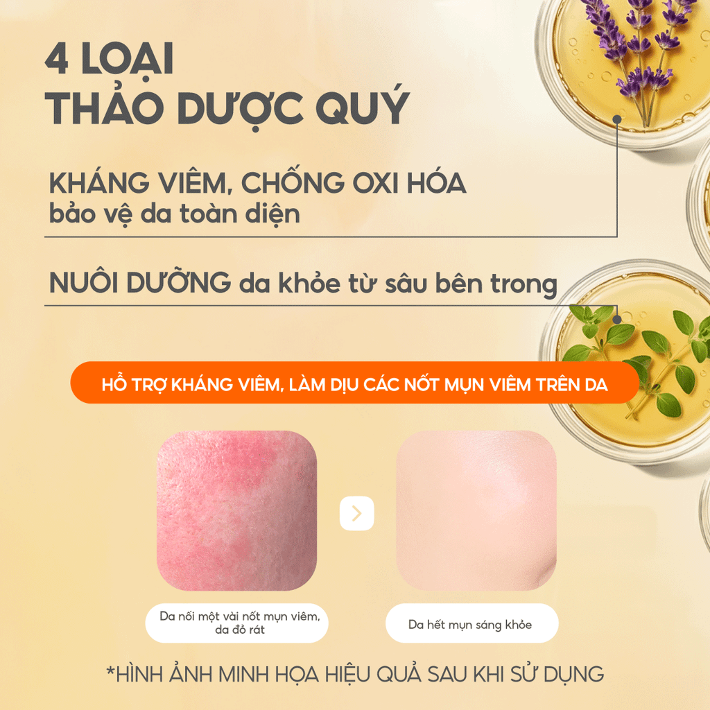 Toner Nấm Chaga Không Cồn Hỗ Trợ Cấp ẩm Dịu Da - G.G.G Calming Mushroom Toner 200ml