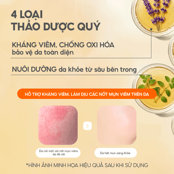 Toner Nấm Chaga Không Cồn Hỗ Trợ Cấp ẩm Dịu Da - G.G.G Calming Mushroom Toner 200ml