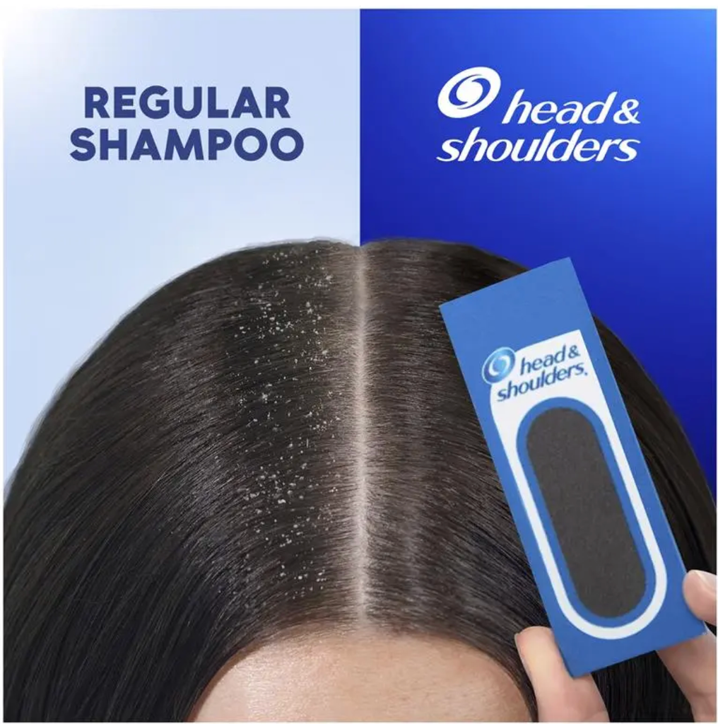 Head & Shoulders Itchy Scalp Care 2in1 Shampoo + Conditioner 750ml