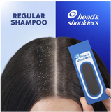 Head & Shoulders Itchy Scalp Care 2in1 Shampoo + Conditioner 750ml