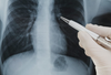 VUNO Med®-Chest X-ray™