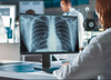 VUNO Med®-Chest X-ray™