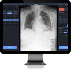 VUNO Med®-Chest X-ray™