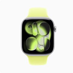 Apple Watch S11 GPS 42mm Viền Nhôm Dây Cao Su (VN/A)