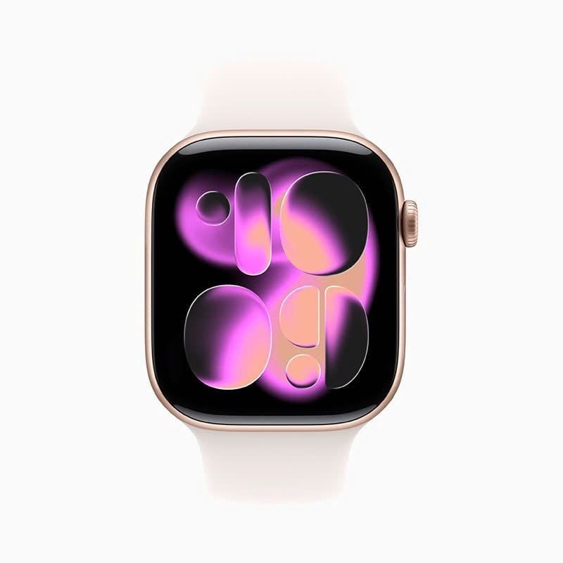 Apple Watch S11 LTE 46mm Viền Nhôm Dây Cao Su (VN/A)