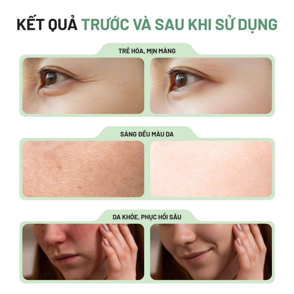 Tinh Chất Nha Đam Xương Rồng Trẻ Hóa Da - Dưỡng Trắng - Se Khít Lỗ Chân Lông 38G
