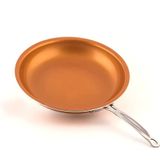  Chảo Chống Dính Đáy Từ Mishio (Size 20, 25, 30cm) MK430 MK431 MK432 - Chống Dính Gốm Cao Cấp, An Toàn Sức Khỏe, Dùng Cho Mọi Loại Bếp 