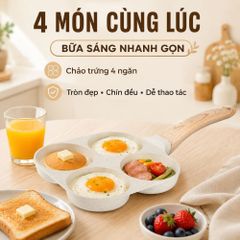 Bộ Nồi Chảo Chống Dính 21 Món Mishio MK469 – Trắng Kem Thanh Lịch, An Toàn Chuẩn FDA