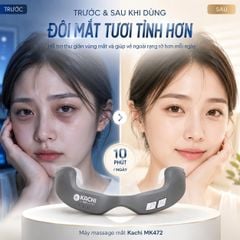 Máy Massage Mắt Kachi MK472: Giải Pháp Công Nghệ Đánh Bay Quầng Thâm và Ánh Sáng Đỏ Tăng Sinh Collagen